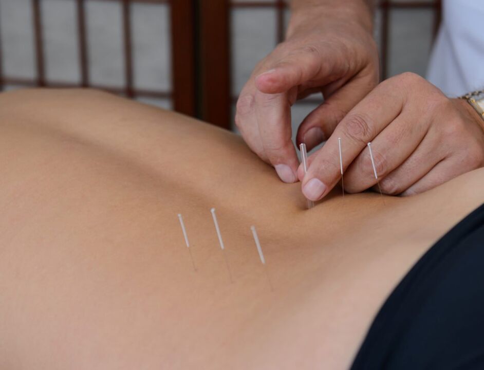 akupunktur untuk prostatitis