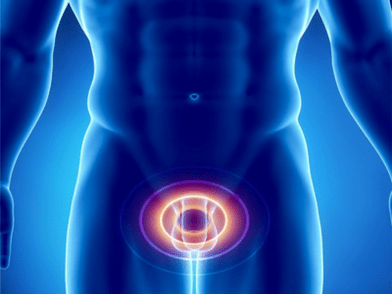 Prostatitis – radang kelenjar prostat pada pria
