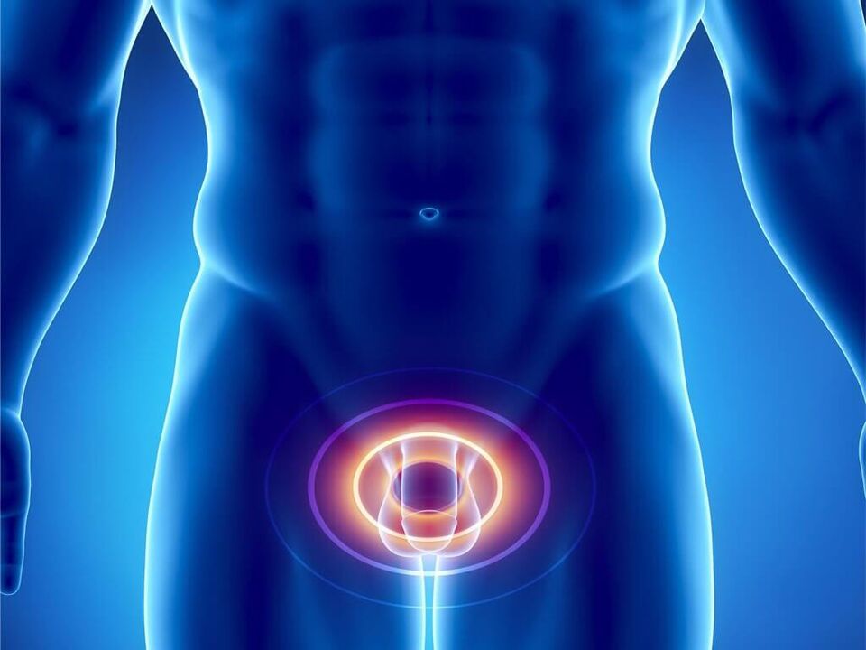 gejala prostatitis pada pria