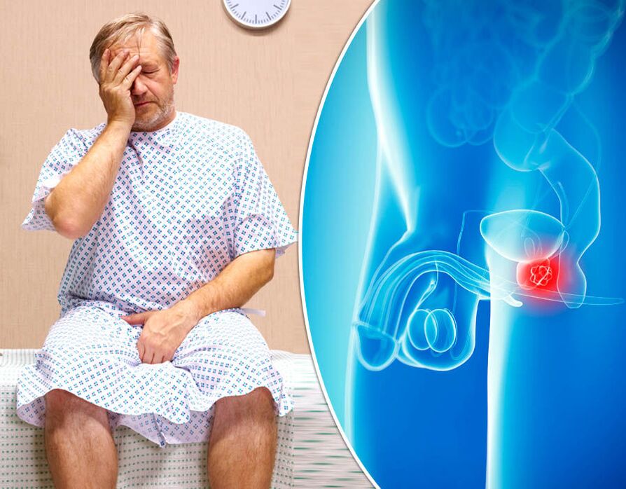 Seorang pria dengan prostatitis sedang didiagnosis dengan suatu penyakit
